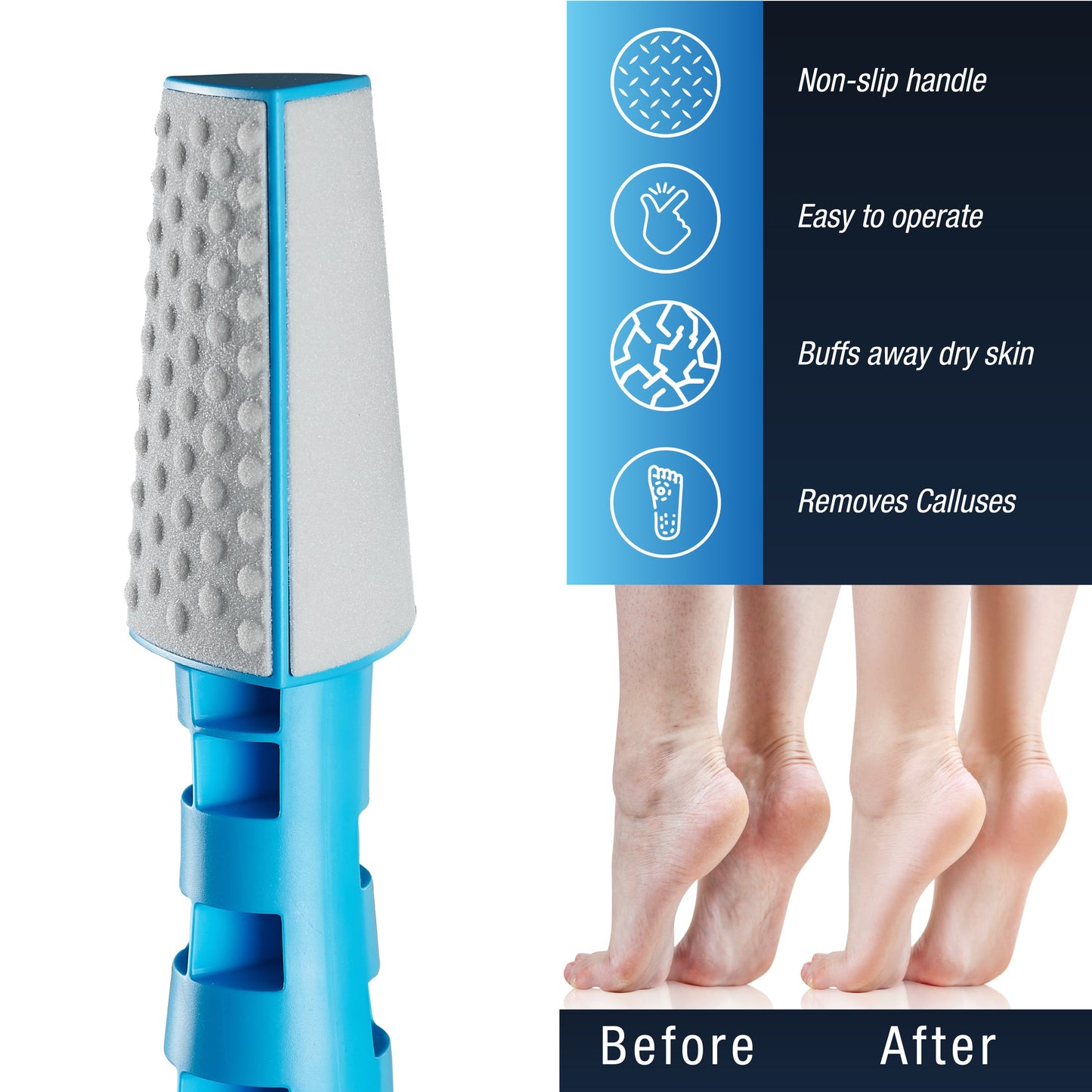 3 In 1 Callus Remover